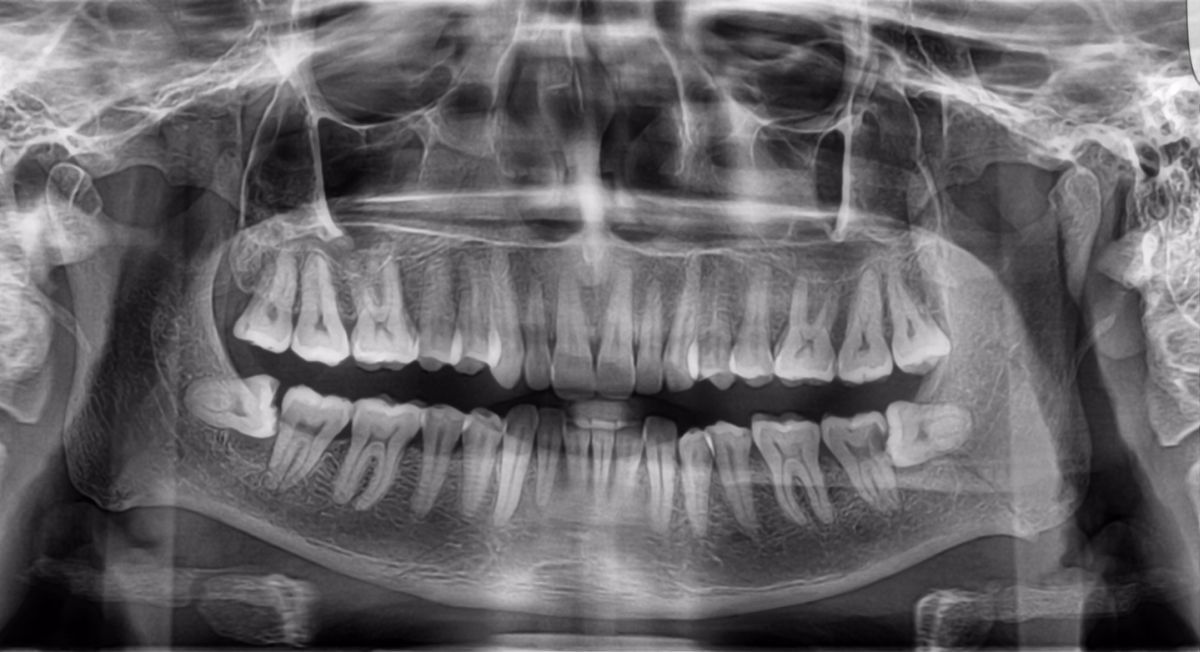 3dental